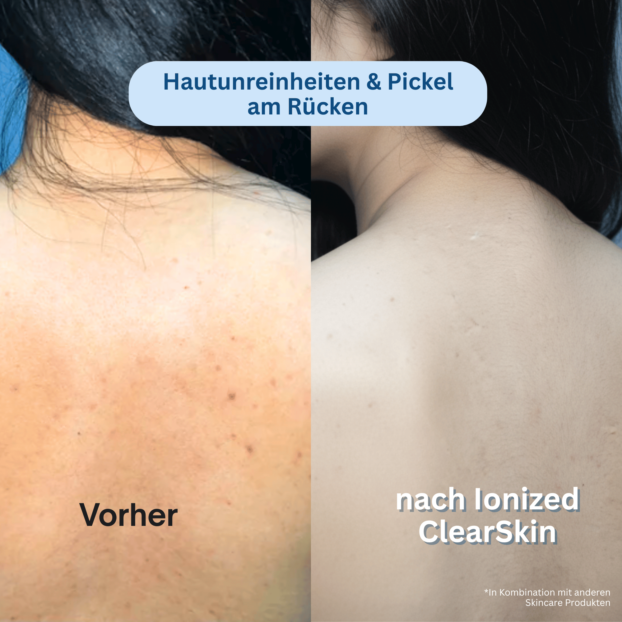 Ionized™ Peeling Duschtuch - Every Day