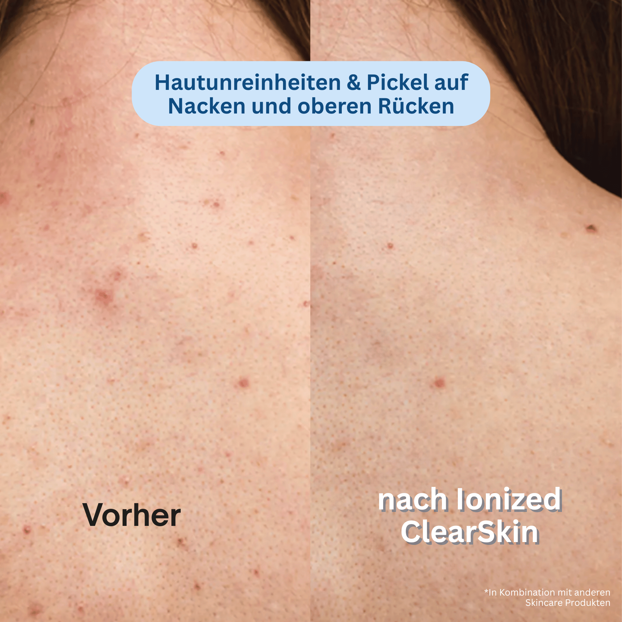 Ionized™ Peeling Duschtuch - Every Day
