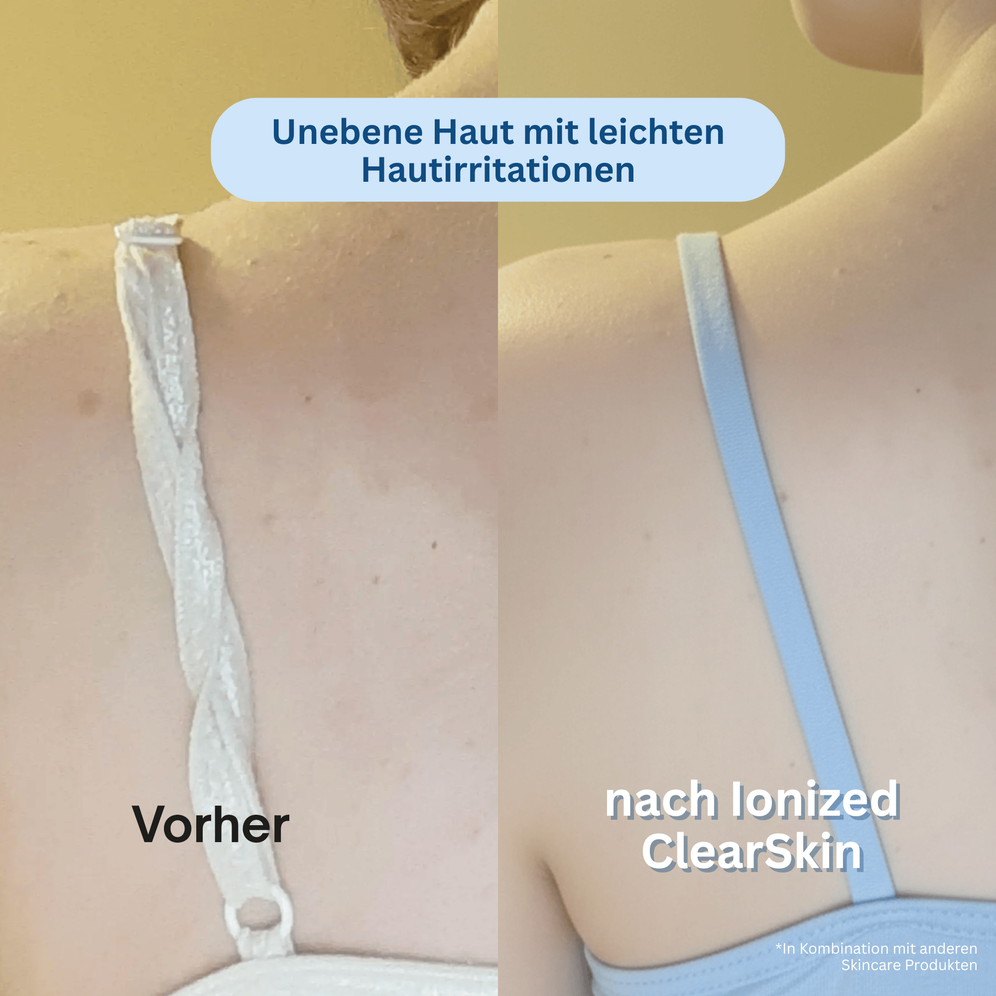 Ionized™ Peeling Duschtuch - Every Day